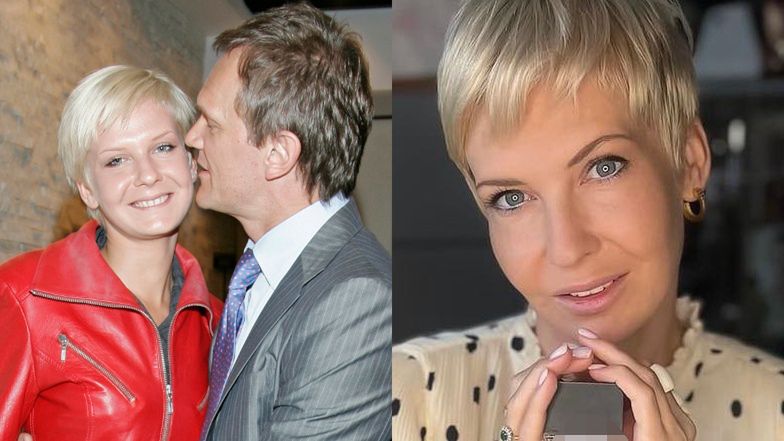 Edyta Pazura ujawnia, czy majstrowała przy twarzy