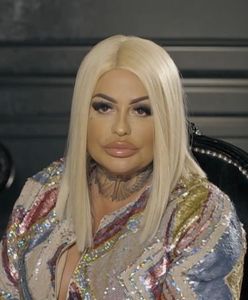 "Królowe życia": Laluna wyliczyła operacje plastyczne. Pokazała, jak wyglądała przed zabiegami