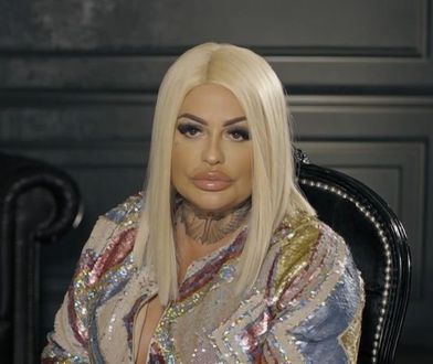 "Królowe życia": Laluna wyliczyła operacje plastyczne. Pokazała, jak wyglądała przed zabiegami