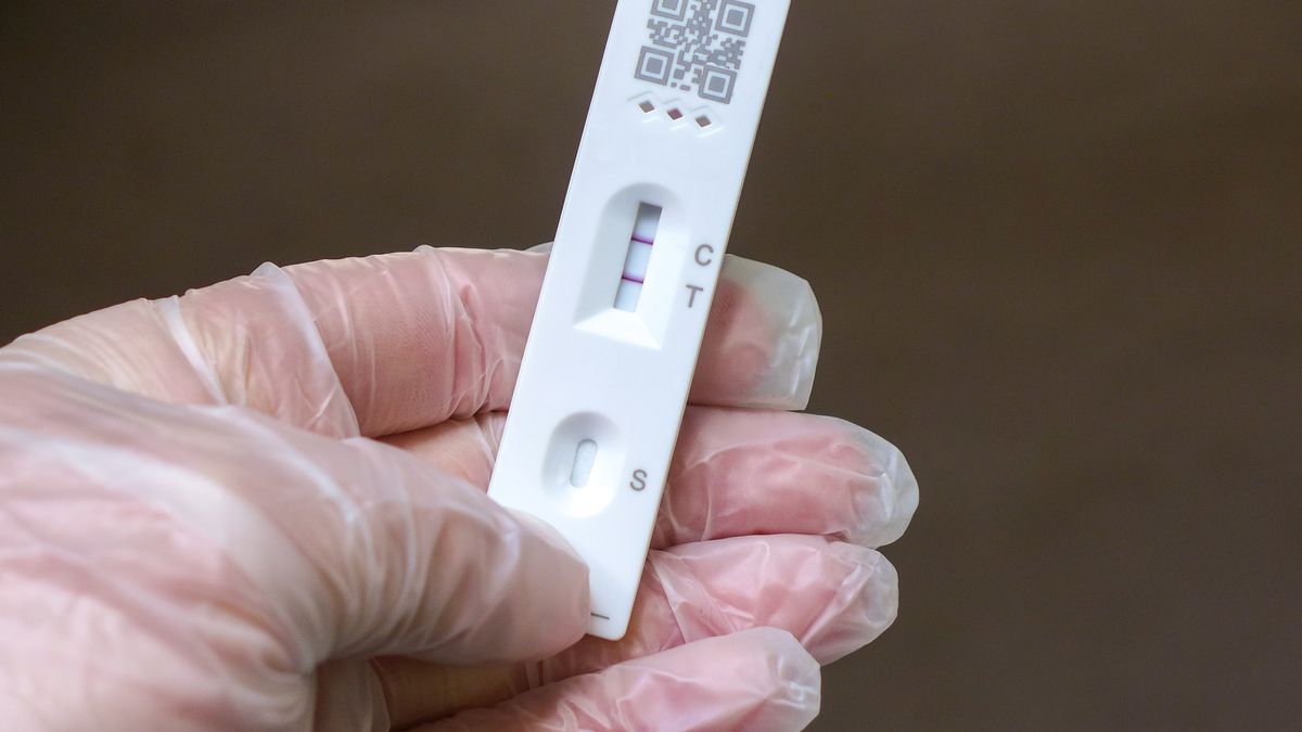 Test na koronawirusa 