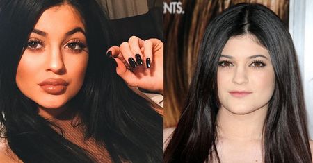 Kylie: "Nie poprawiałam ust. Nie wykluczam, że niebawem to zrobię"