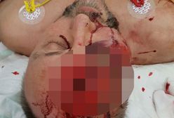 Niemiecki polityk został ciężko pobity. W tym roku spokoju nie będzie