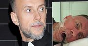 Nergal pokazał zdjęcia ze szpitala. Pierwsze już widzicie, drugie jest bardziej drastyczne