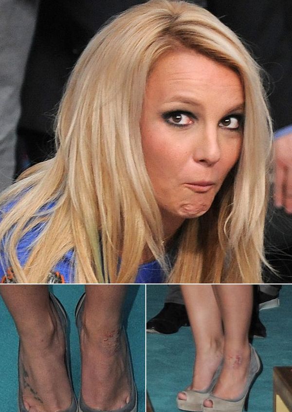 "X Factor": nogi Britney Spears oszpecone przez łuszczycę!