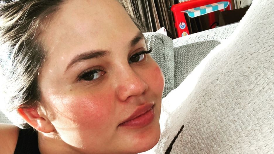 Chrissy Teigen stawia na szczerość