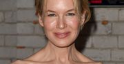 Renee Zellweger i operacje plastyczne. Aktorka słyszała bolesne komentarze