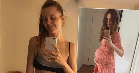 Kasia Burzyńska dwa tygodnie po porodzie pokazała swój brzuch! To co zobaczycie na zdjęciu nie mieści się w głowie! Stał się cud!
