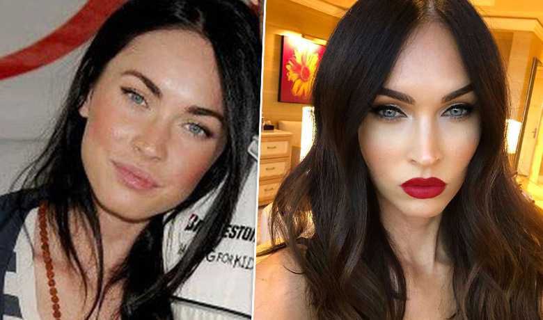 Megan Foxx- przed i po korekcie ust