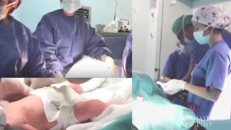 64-latka urodziła bliźnięta