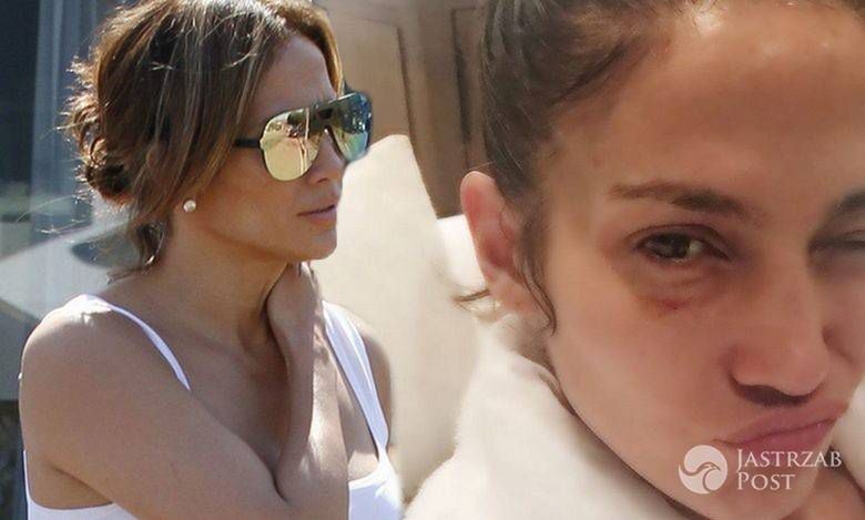 Przerażające zdjęcie Jennifer Lopez wyciekło do sieci tuż po newsie o ślubie!