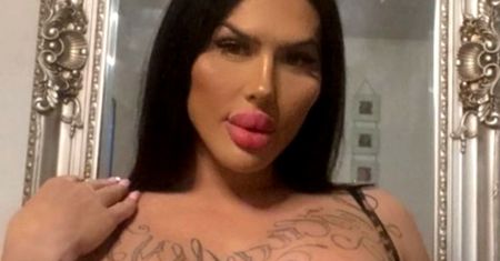 Ma największe usta w Wielkiej Brytanii. Powiększała je 100 razy