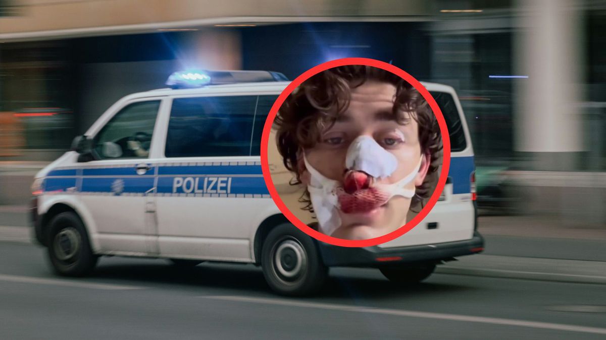 Amerykanin zaatakowany w Niemczech