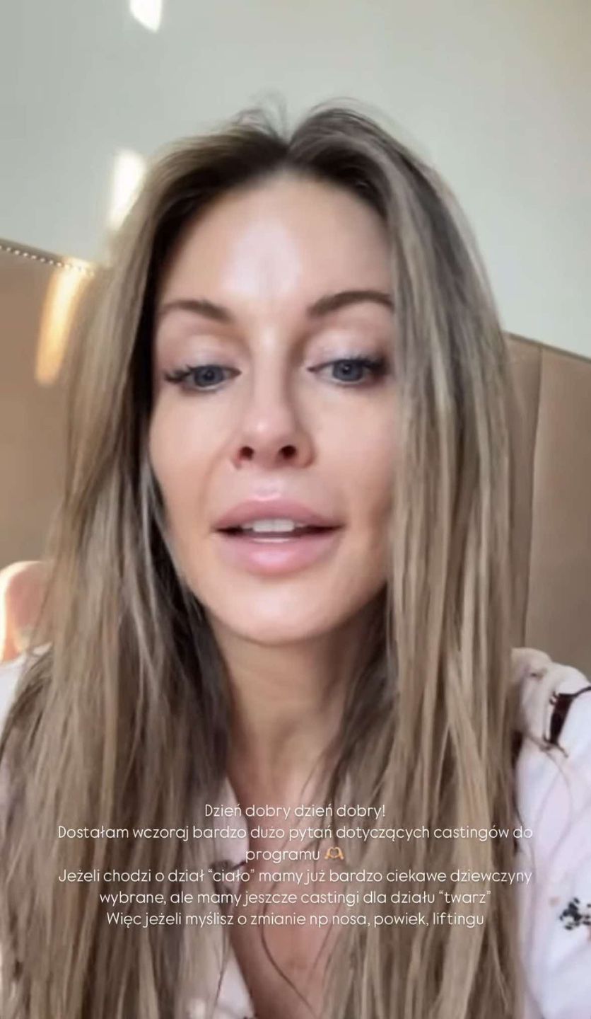 Małgorzata Rozenek prezentuje "naturalne" oblicze z rana