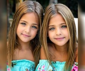Mówiono, że to "najpiękniejsze bliźniaczki świata". Mają już 14 lat