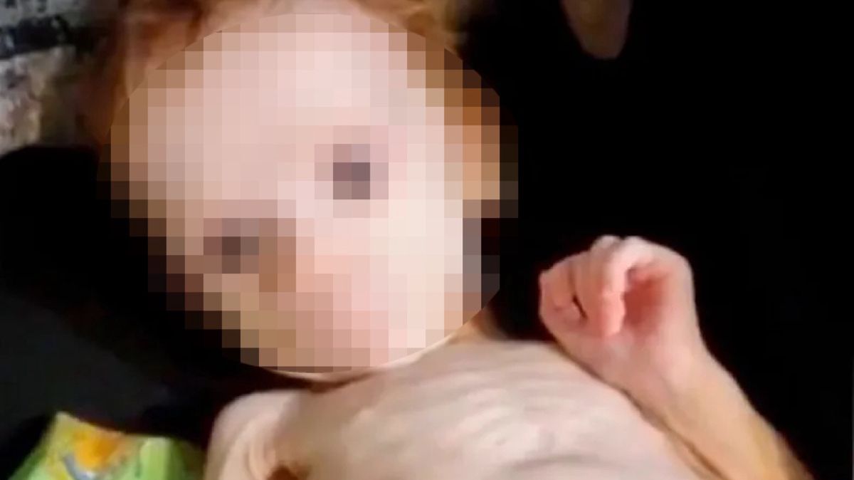 wygłodzone niemowlę