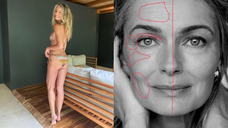 Modelka pokazuje, jak wygląda bez filtrów