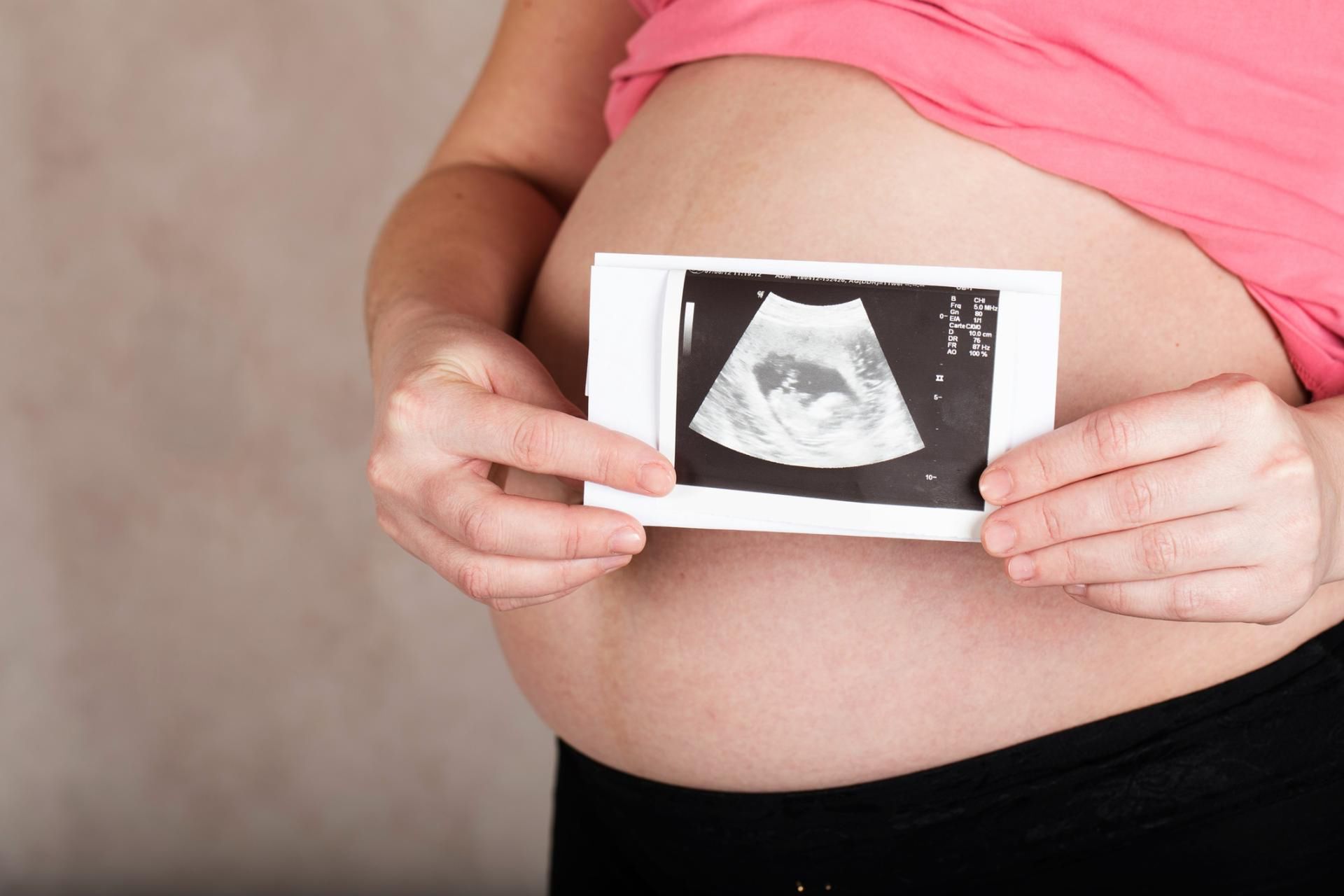 Badanie USG ujawniło, że to była ciąża bliźniacza