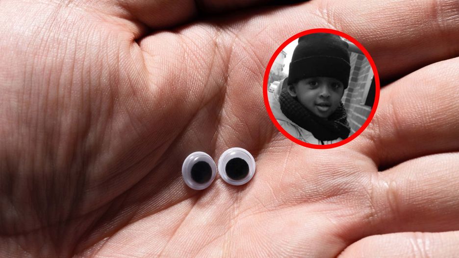 Dwulatek połknął plastikowe oczy z zabawki