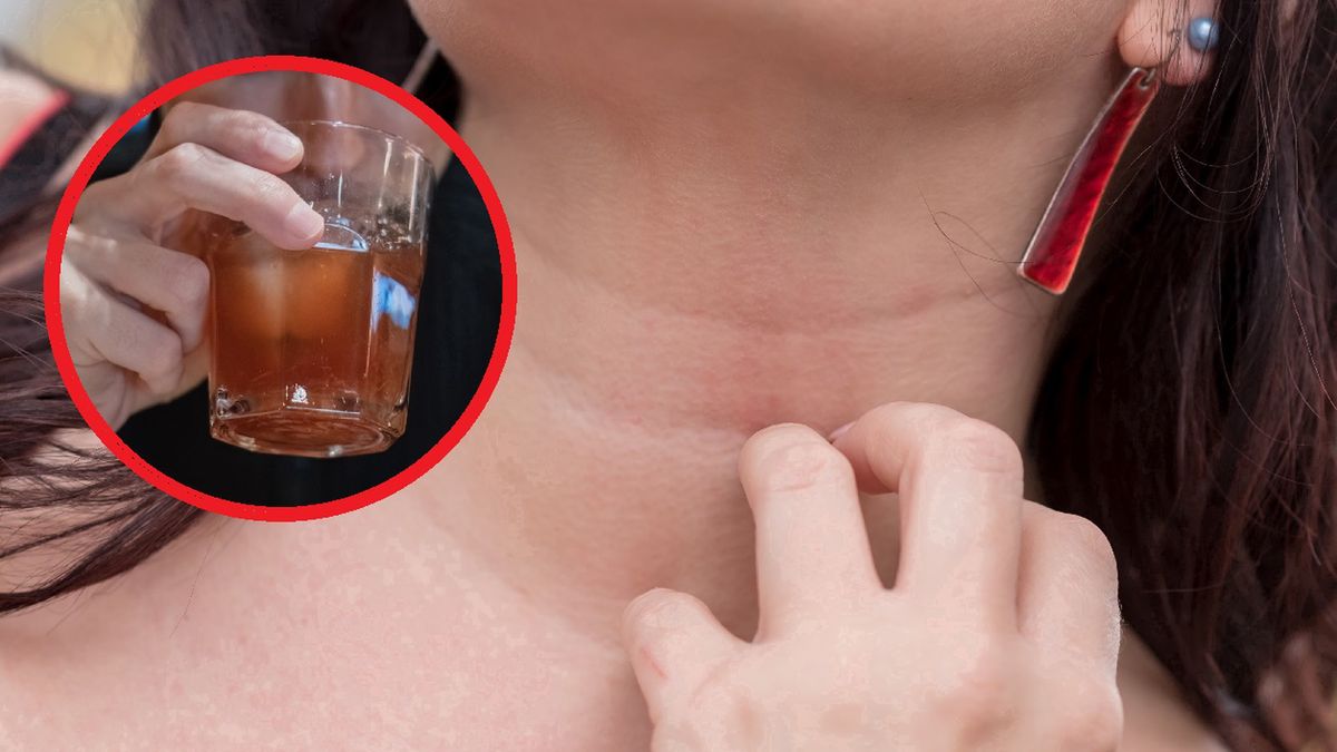 Tak organizm broni się przed alkoholem. To nie jest zwykły objaw