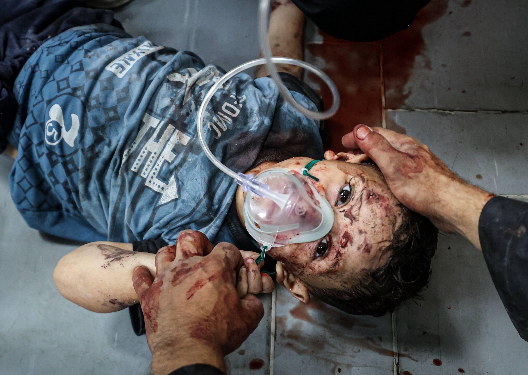Israeli attacks on Gaza continue
