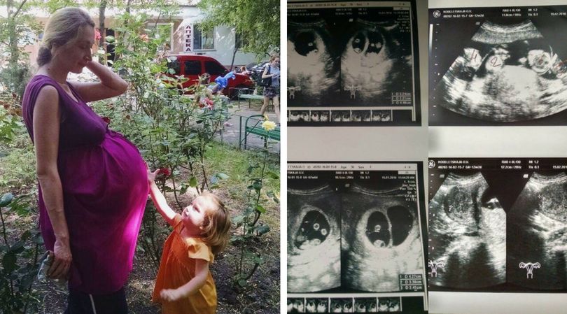 Ciąża Oksany to pierwszy taki przypadek na Ukrainie