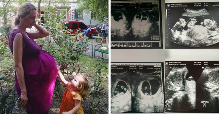 Kiedy kobieta trafiła na porodówkę, lekarze byli przygotowani na najgorsze. Nigdy nie spotkali się z podobnym przypadkiem