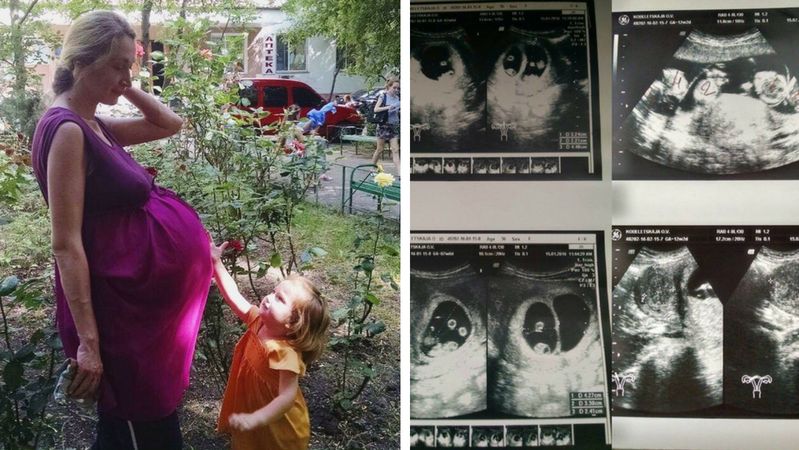 Ciąża Oksany to pierwszy taki przypadek na Ukrainie