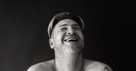 Kelly Jay zrobiła zdjęcia osób z bliznami, by pokazać ich historie