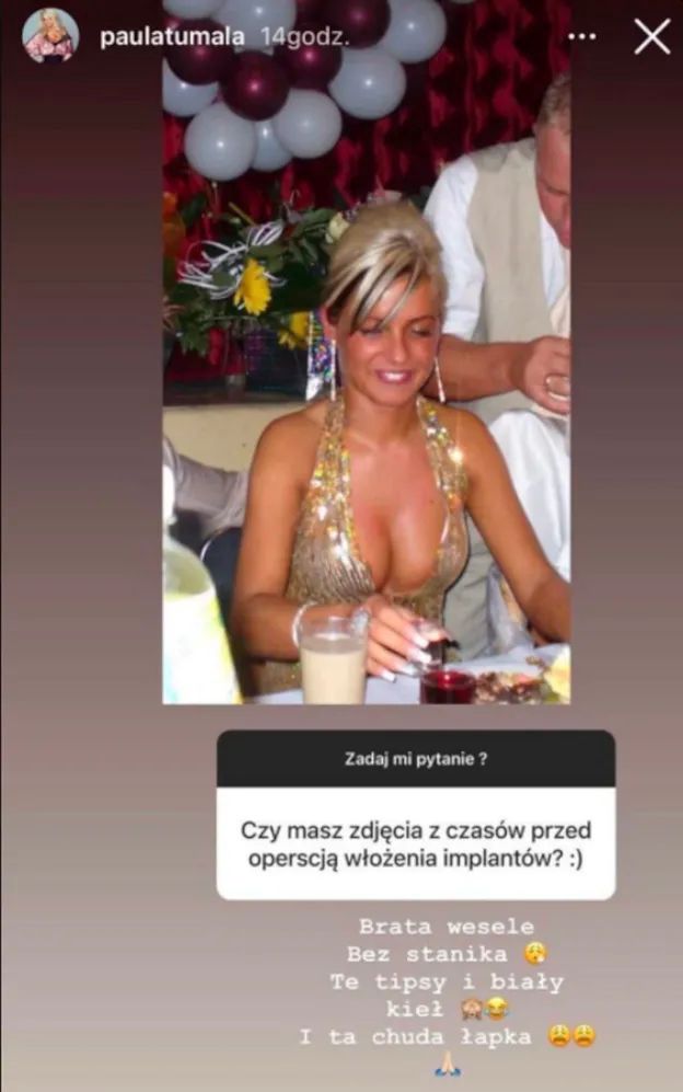 Paulina Tumala przed operacjami