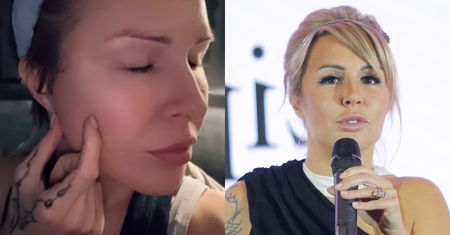 Blanka Lipińska ujawnia ciemne strony liftingu. Celebrytka NIE MA CZUCIA w części twarzy. "Minęły trzy miesiące, a ja dalej mam OBRZĘKI"