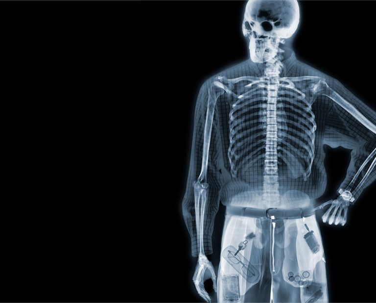 Nick Veasey - mistrz aparatu...rentgenowskiego 4