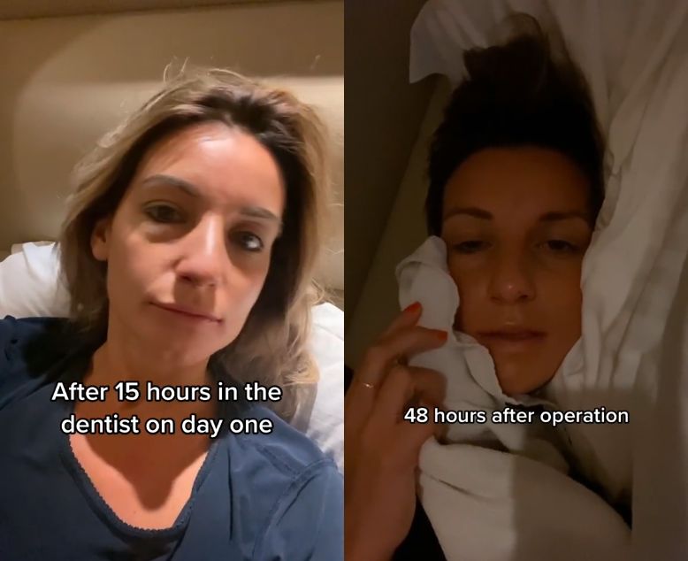 Turecka metamorfoza z piekła rodem