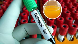 Tarcza ochronna dla serca. Pij, by obniżyć ciśnienie i cholesterol