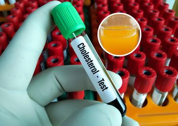 Tarcza ochronna dla serca. Pij, by obniżyć ciśnienie i cholesterol