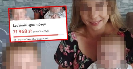 Oszustka z Dolnego Śląska wymyśliła guza mózgu. Prokuratura ma ważny apel