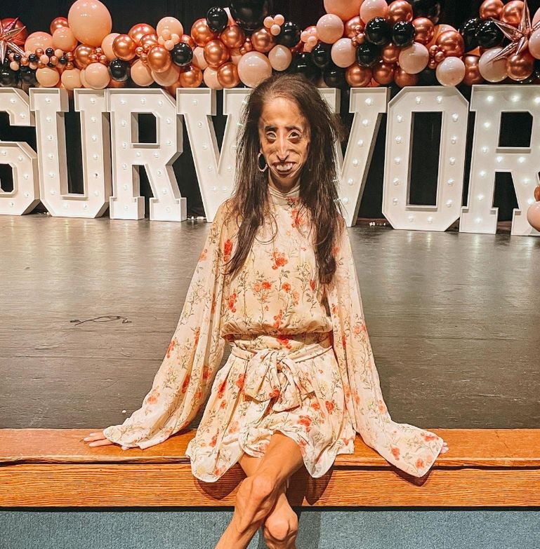 Lizzie Velasquez
