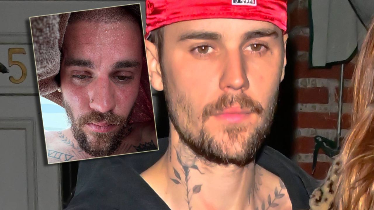 Justin Bieber prawi o DETOKSIE. Fani zaniepokojeni faktycznym stanem gwiazdora