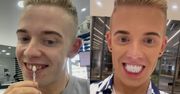 Brytyjczyk zrobił sobie transformację uśmiechu. Dentystka nie wytrzymała na widok jego "TURECKICH ZĘBÓW"... (WIDEO)