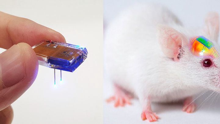 implant