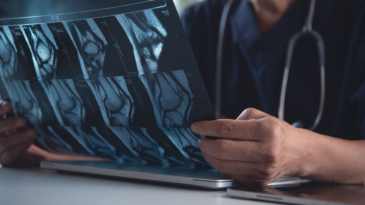 Sztuczne RTG wyglądają jak prawdziwe?