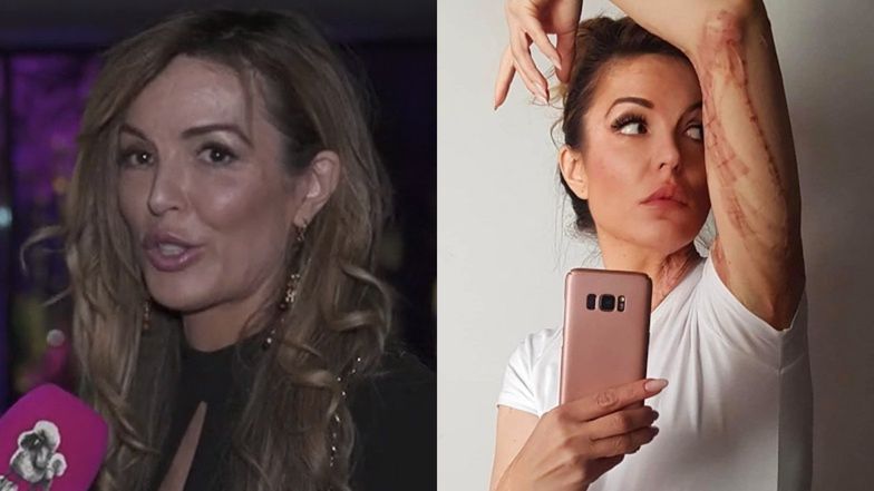 Katarzyna Dacyszyn opowiada o ataku stalkera (fot. Pudelek Exclusive; fot. Instagram)