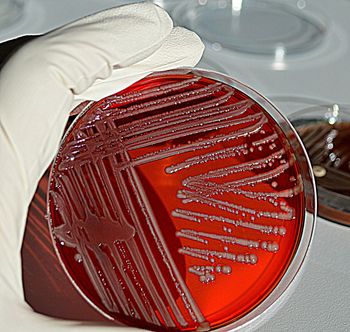 Sztuczna inteligencja kontra superbakterie. Stworzyła nowe antybiotyki