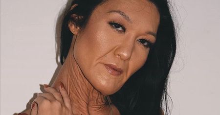 Ma zespół Ehlersa-Danlosa. Sara Geurts poznała diagnozę w wieku 10 lat