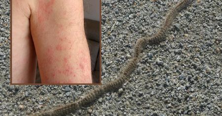 Trujące gąsienice na placu zabaw. Powodują poważne reakcje alergiczne