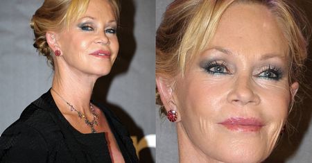 Co się stało z twarzą Melanie Griffith? (ZDJĘCIA)