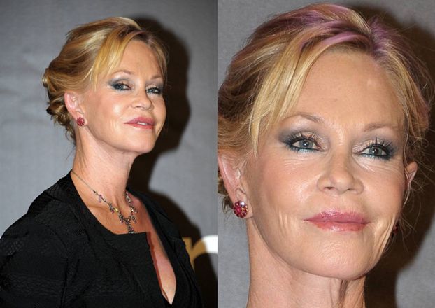 Co się stało z twarzą Melanie Griffith? (ZDJĘCIA)