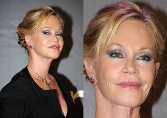 Co się stało z twarzą Melanie Griffith? (ZDJĘCIA)