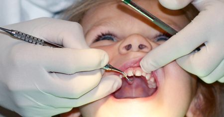 Zmiany od 1 stycznia. Nowe świadczenia dentystyczne dla dzieci