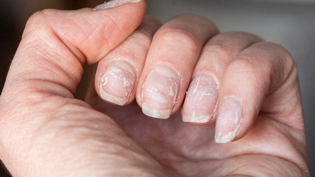 Jak uratować zniszczone paznokcie po hybrydzie?