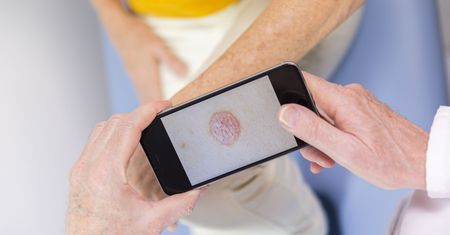 Google wykorzysta sztuczną inteligencję do rozpoznawania chorób skóry